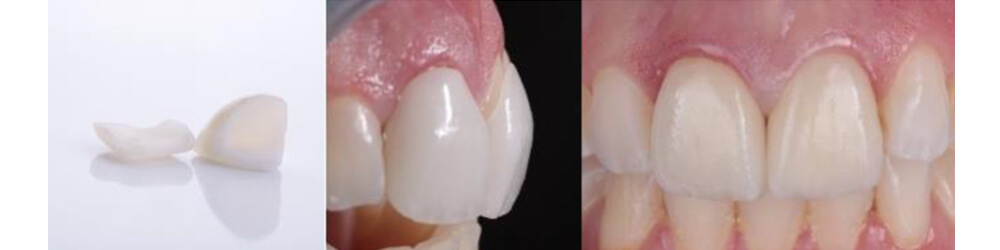 Caso clínico Dr Paulo Monteiro