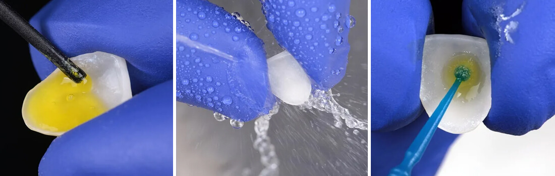 Caso clínico Dr Paulo Monteiro