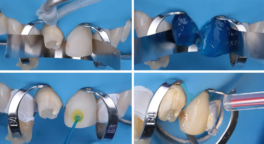 Caso clínico Dr Paulo Monteiro