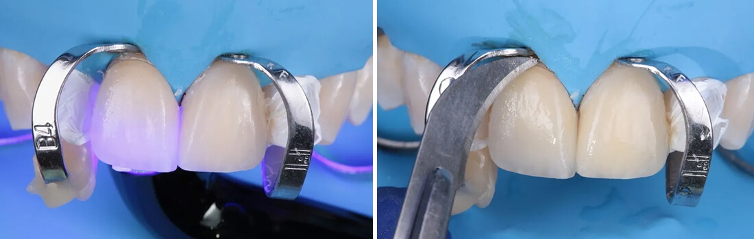 Caso clínico Dr Paulo Monteiro