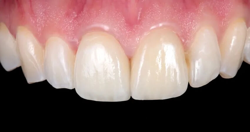 Caso clínico Dr Paulo Monteiro