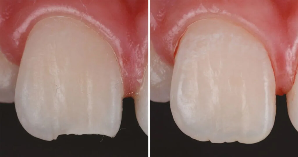 Composites fluides