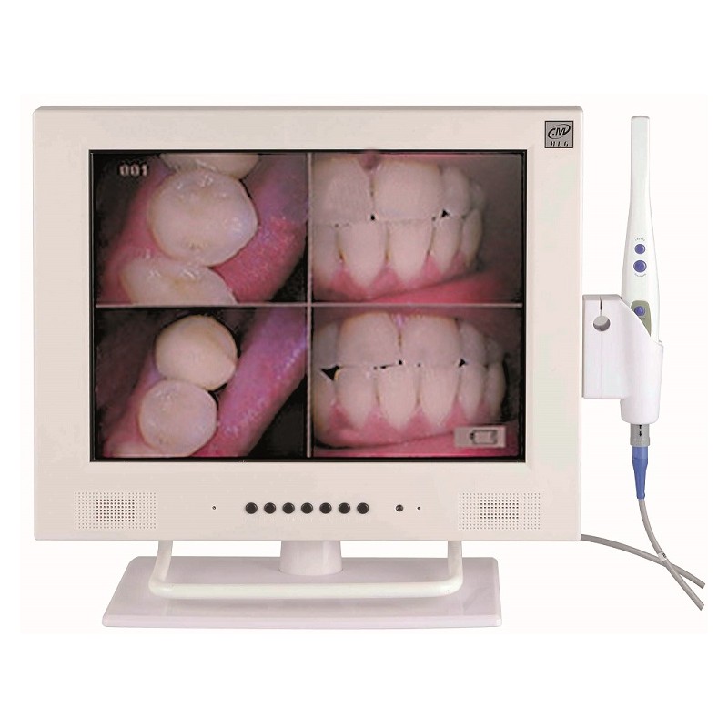 camara intraoral con sisstema autofocus de Mestra