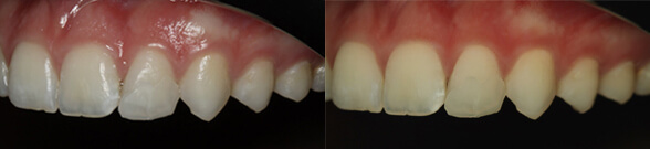 cas clinique 2