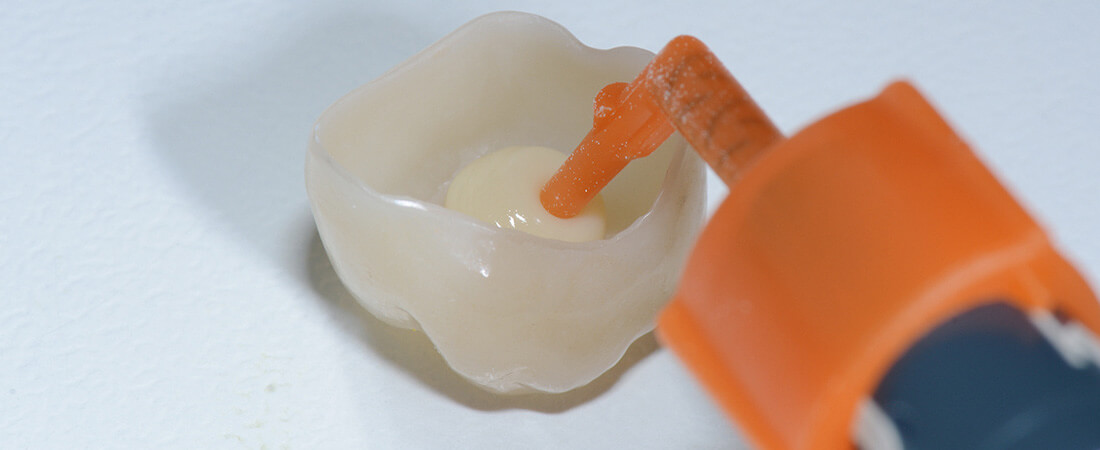 cas clinique scellement adhésif