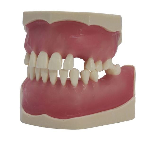 TIPODONTO DE CIRUGÍA Img: 201807031