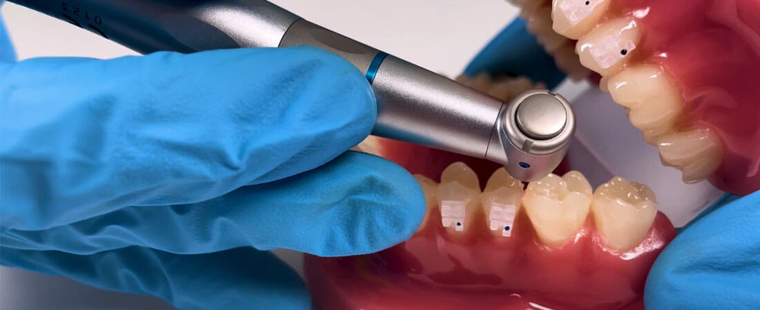 Contra ángulos dentales