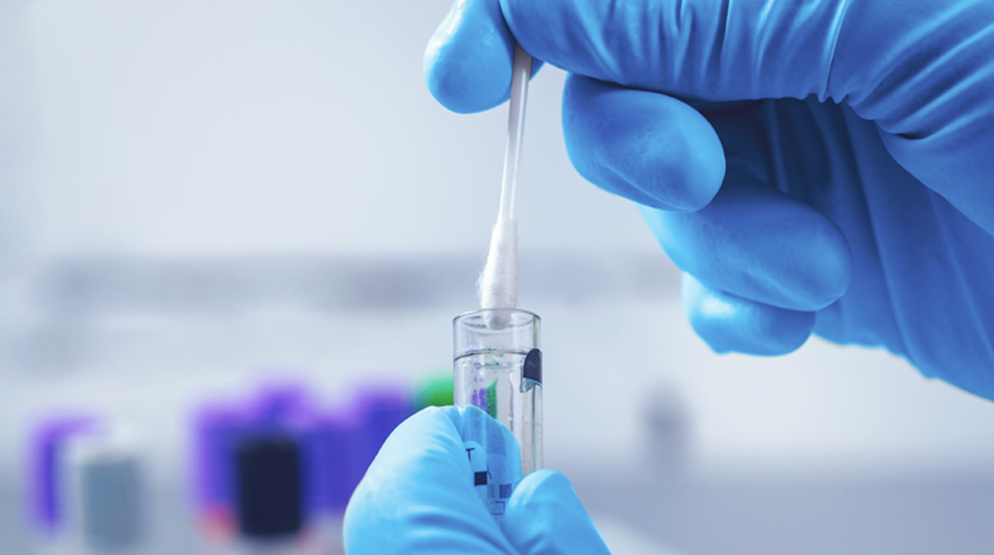 Test rapidos para la deteccion de antigenos en clinicas dentales