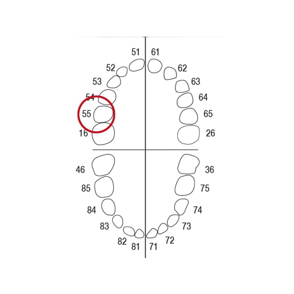 AK62ZE nº 55 Dientes caducos y molares para modelo AK-6/2 Img: 202208201