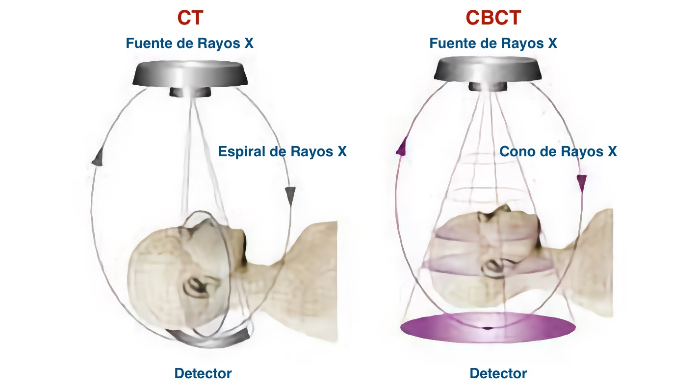 Diferencias entre CT y CBCT