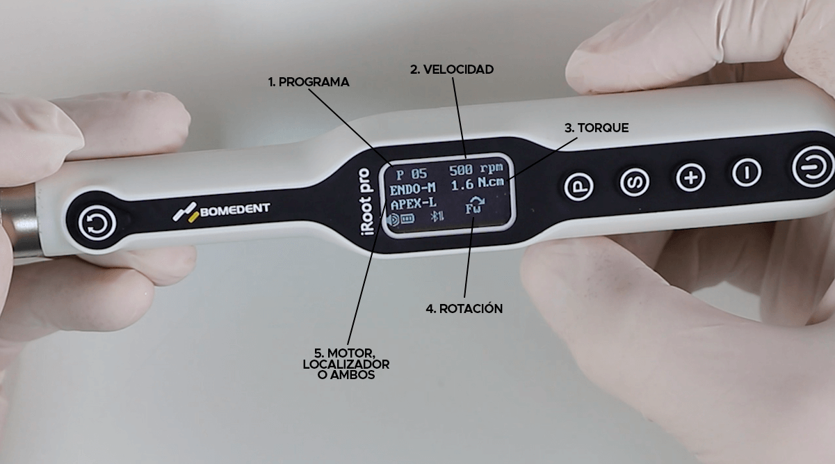 Funcionalidades del Motor iRoot Pro de Bondent