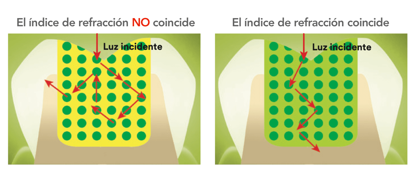 Mito: Un composite Bulk Fill colocado en un incremento de 5 mm no logrará la profundidad de curado adecuada.