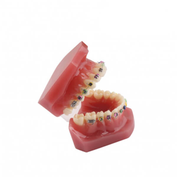 modelo-be-bracket-bader-3