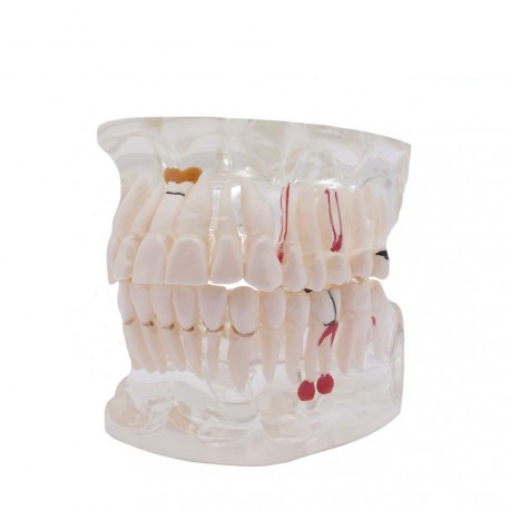 Tipodonto transparente Patologías p/implantes Img: 201807031