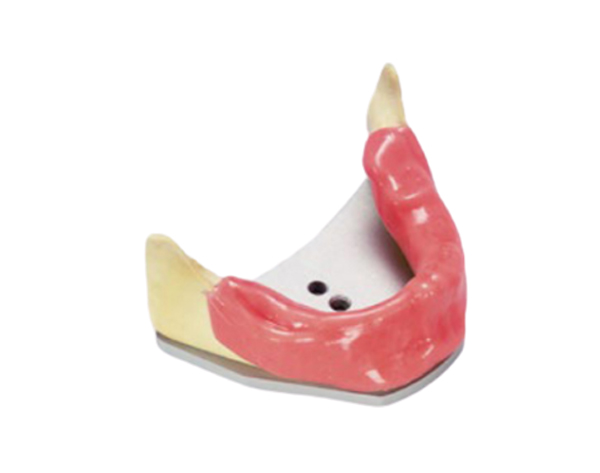 Modelo A-J KWA para Práctica de Implantes (Mandíbula Edéntula + Encía y Placa de Montaje) Img: 202009261
