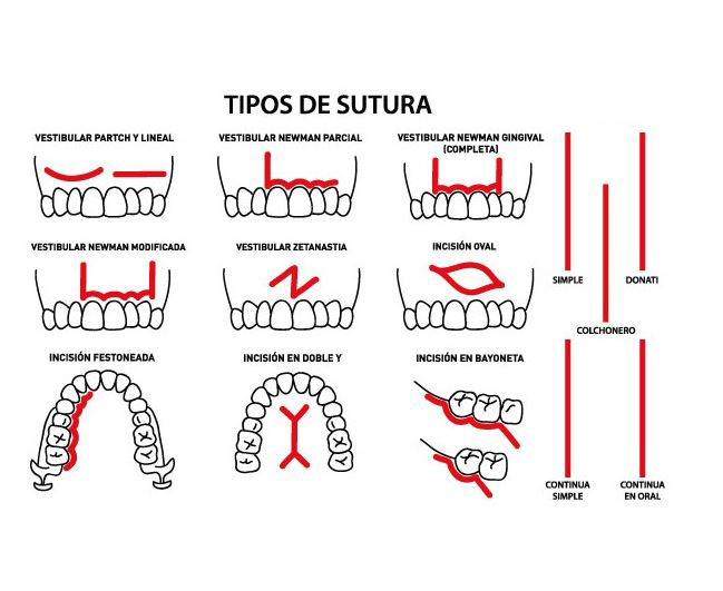 MODELO PARA PRÁCTICA DE SUTURA Img: 201807031