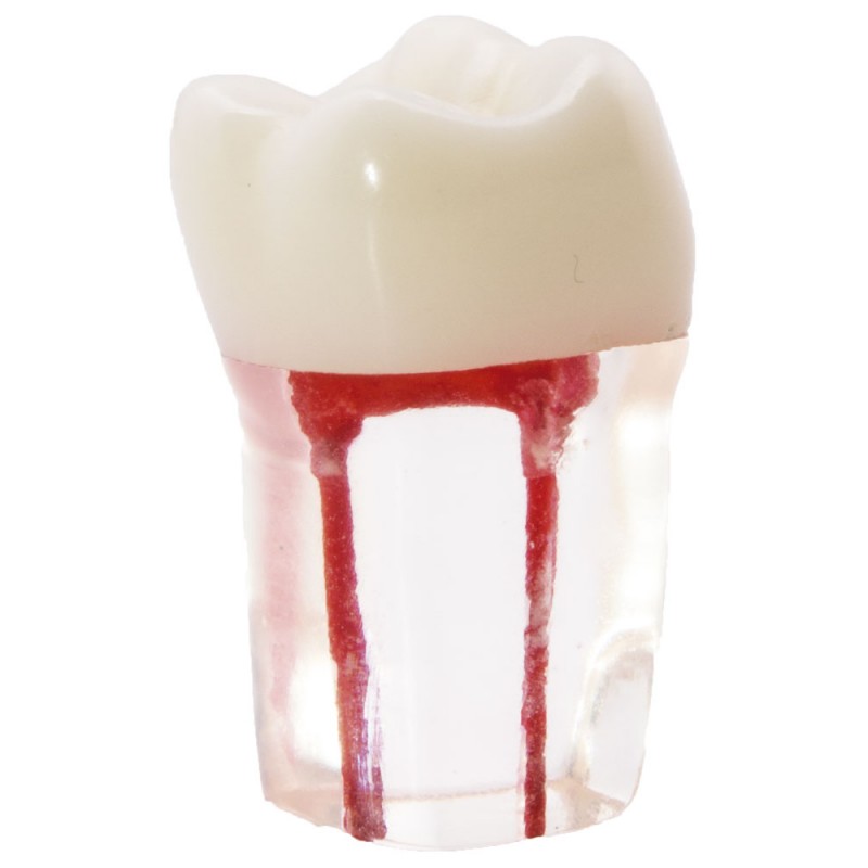 MOLAR CON CONDUCTOS RADICULARES PARA ESTUDIANTES