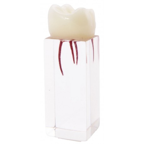 Molar para endodoncia