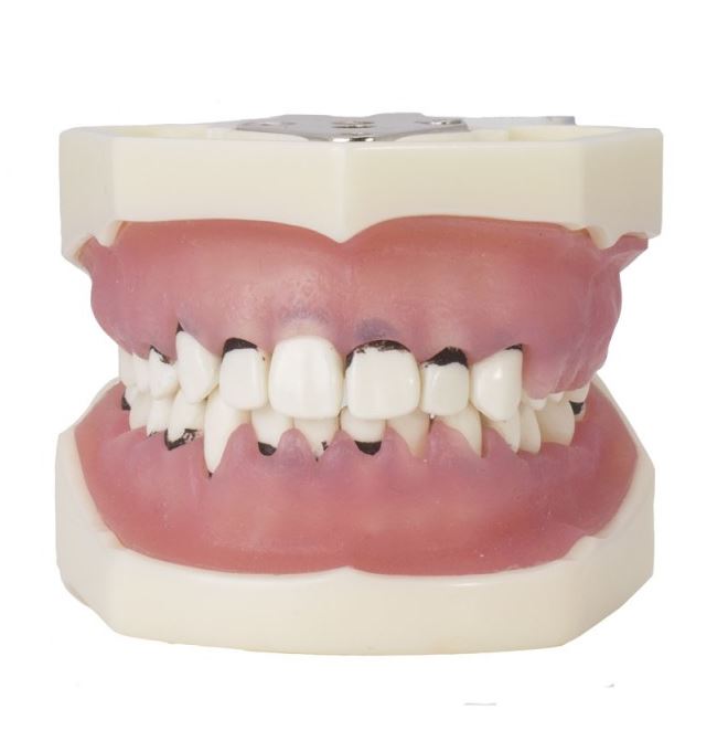 TIPODONTO DE PERIODONCIA CON ARTICULADOR  Img: 201807031