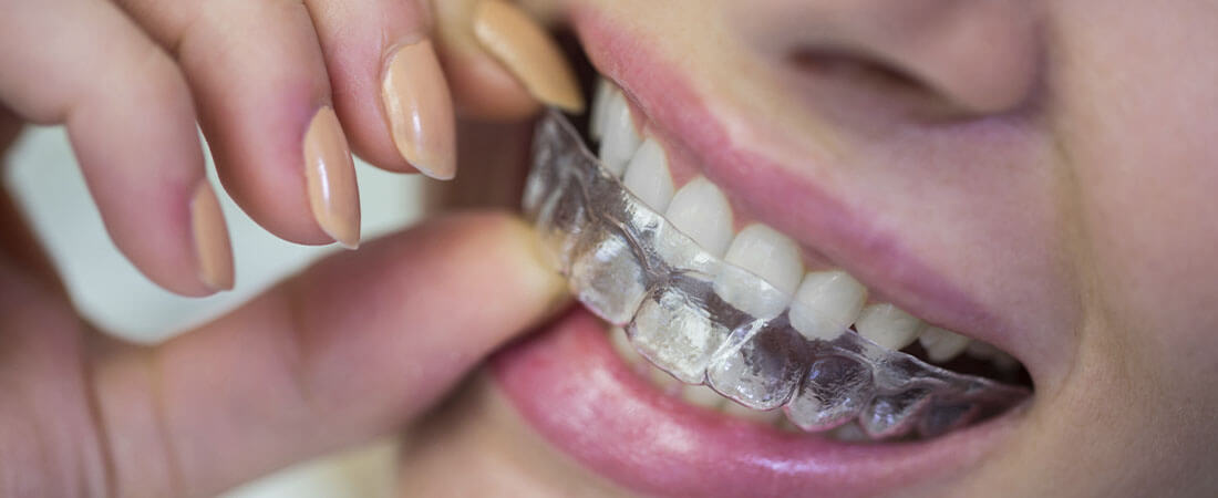 Planchas termoplásticas dentales
