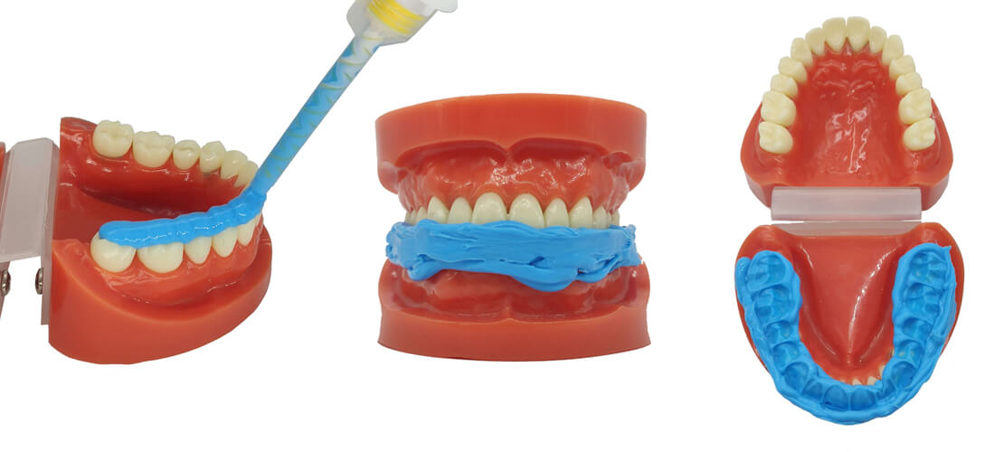 Silicone pour l'enregistrement de l'occlusion