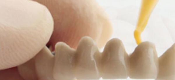 Cemento dental: todos sus tipos y usos - Mejor con Salud
