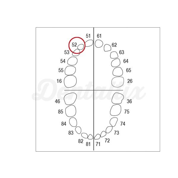 AK-6 ZE nº 52 Dientes caducos y molares para modelo AK-6 Img: 202208131
