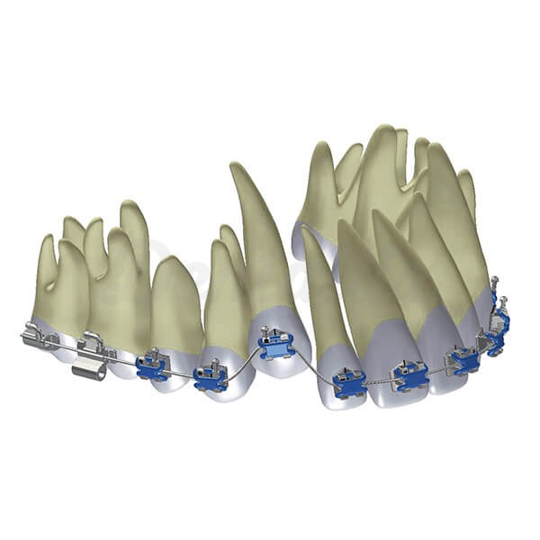 Arcos Preformados Memoria Superior 016 (10 Ud.) - 0.16 Sup - 10 Ud Img: 202501251