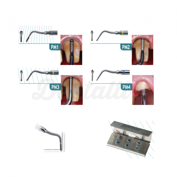 INSERTO SATELEC perfect margin rounded kit Img: 201807031