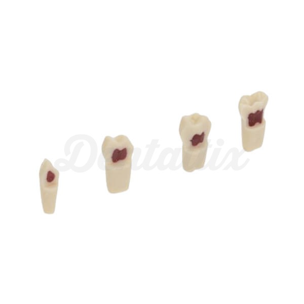 AK62Z: Modelo de Piezas Dentales Temporales para Preparaciones (10ud) - AK62ZPUW - Nº55 - 10 Ud Img: 202501251