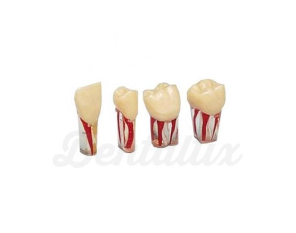 Dientes transparentes para Endodoncia - Tipodondo AG-3 - Nro 24 Img: 202008011