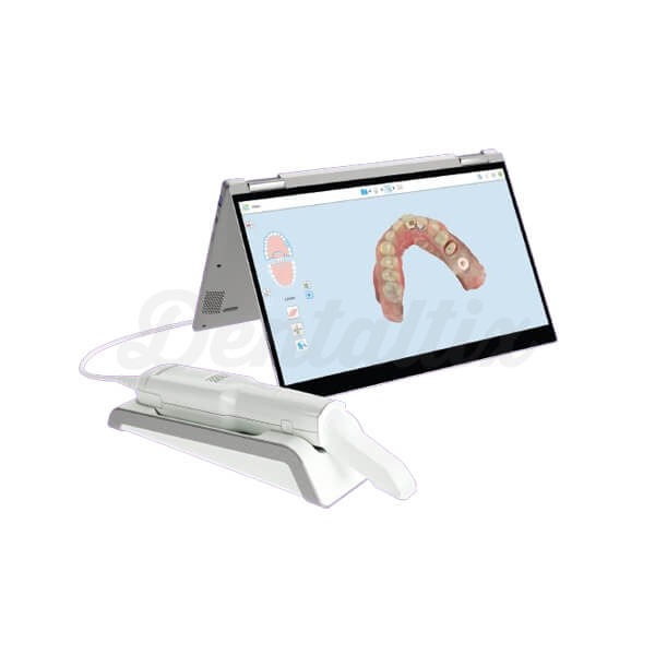 iTero Element Flex CPO: Escáner Intraoral Img: 202503151