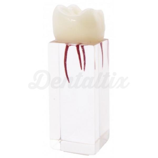 Molar para endodoncia