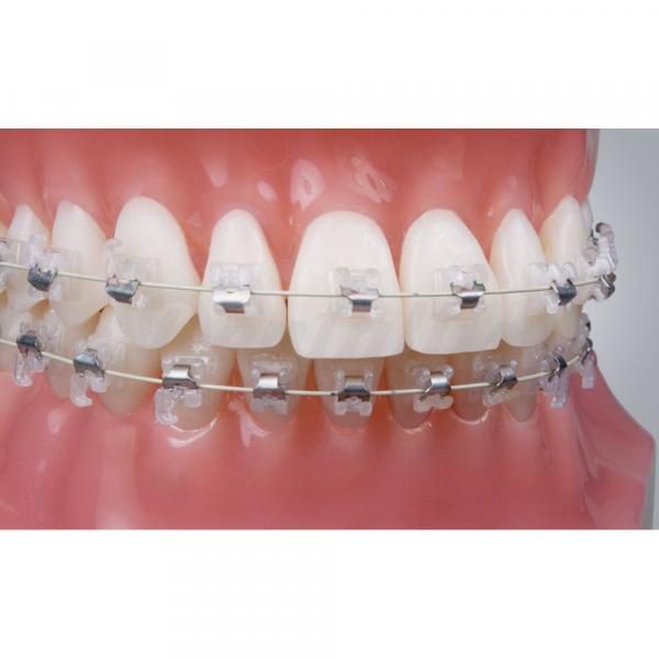 Brackets Autoligado Cerámico Roth 0,22" Sensation (5ud.) ORTHO