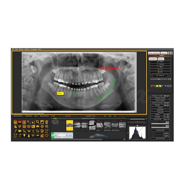 Mediadent: Software de Gestión de Imagenes Dentales