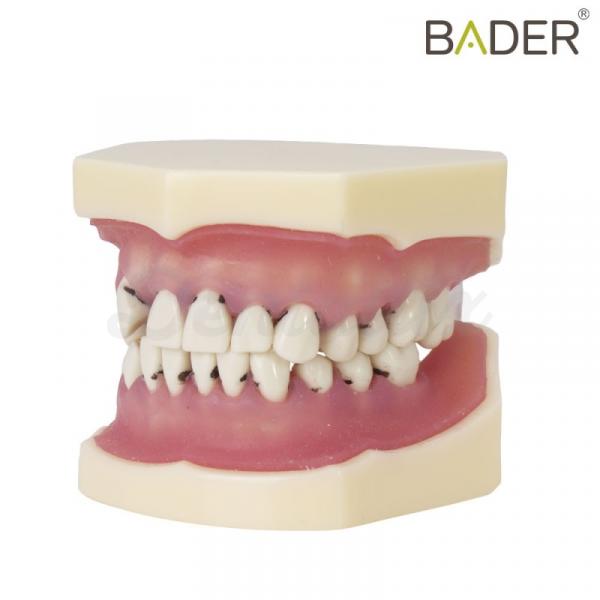 TIPODONTO DE PERIODONCIA BADER Img: 201807031