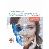 Ajuste Oclusal En Implantes Y Dientes Naturales - Vicente Jiménez López (Libro digital) Img: 202107311