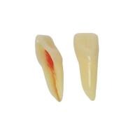 ANA4Z3RN11 diente endo c/raiz natural. apto RX. 3 capas nº11 Img: 202208131 ANA4Z3RN11 diente endo c/raiz natural. apto RX. 3 capas nº11 Img: 202208131