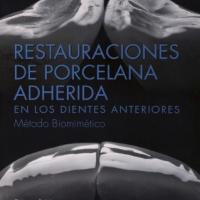 Restauraciones De Porcelana Adherida En Los Dientes Anteriores: Un Enfoque Biomimético - Pascal Magne y Urs Belser Img: 202107311