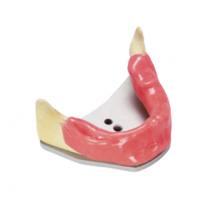 Modelo A-J KWA para Práctica de Implantes (Mandíbula Edéntula + Encía y Placa de Montaje) Img: 202009261