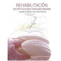 Rehabilitación Estética En El Sector Anterior - El Paso A Paso En La Rutina Clínica - Raphael Monte Alto Img: 202107311