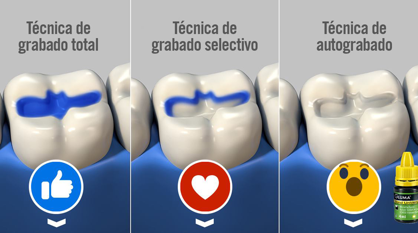 paciente con ácido grabador