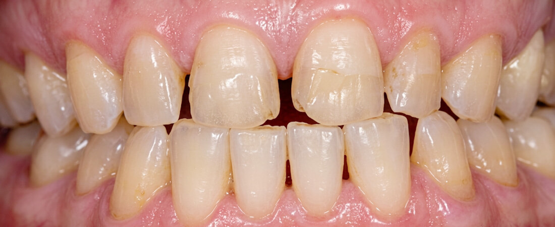 caso clínico tempsmart dc