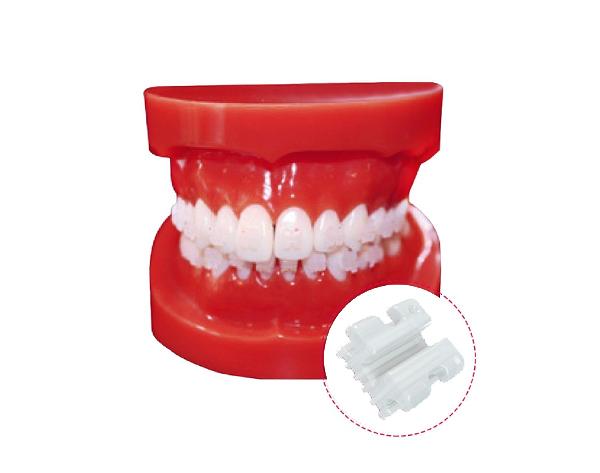 Tipodonto con Brackets Cerámicos Andry White Img: 202008011