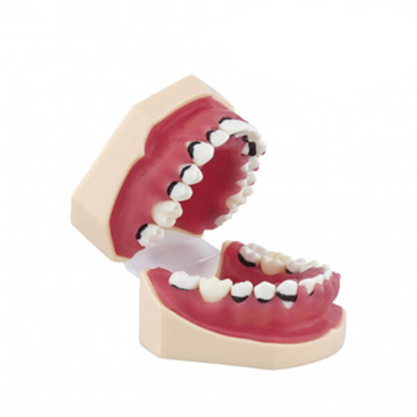 tipodonto-de-periodoncia-2