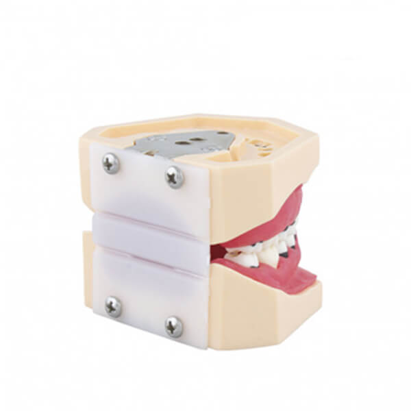 tipodonto-de-periodoncia-3