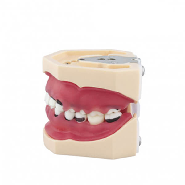 tipodonto-de-periodoncia-4