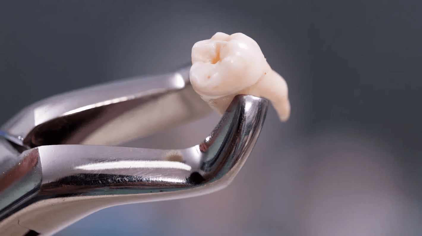 Tipos de fórceps dentales en odontología