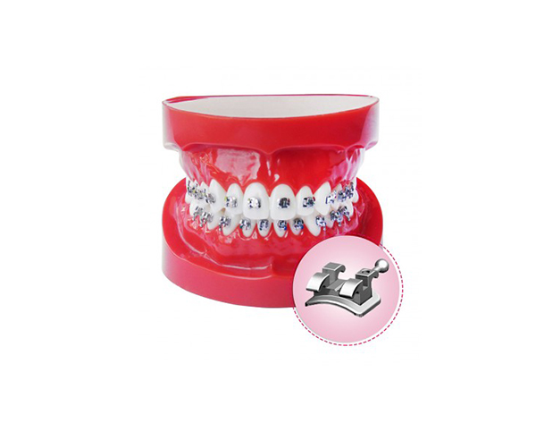 TIPODONTO SKS c/brackets metálicos celu series Img: 201908031