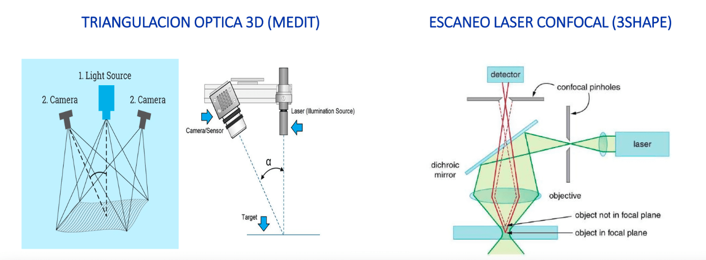 Triangulación óptica 3D vs. laser confocal